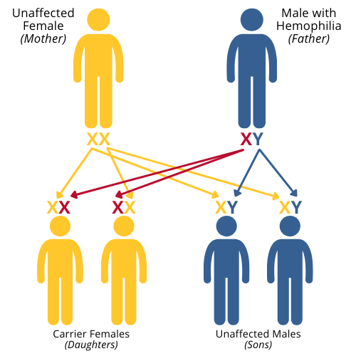 hemophilia genetics 1