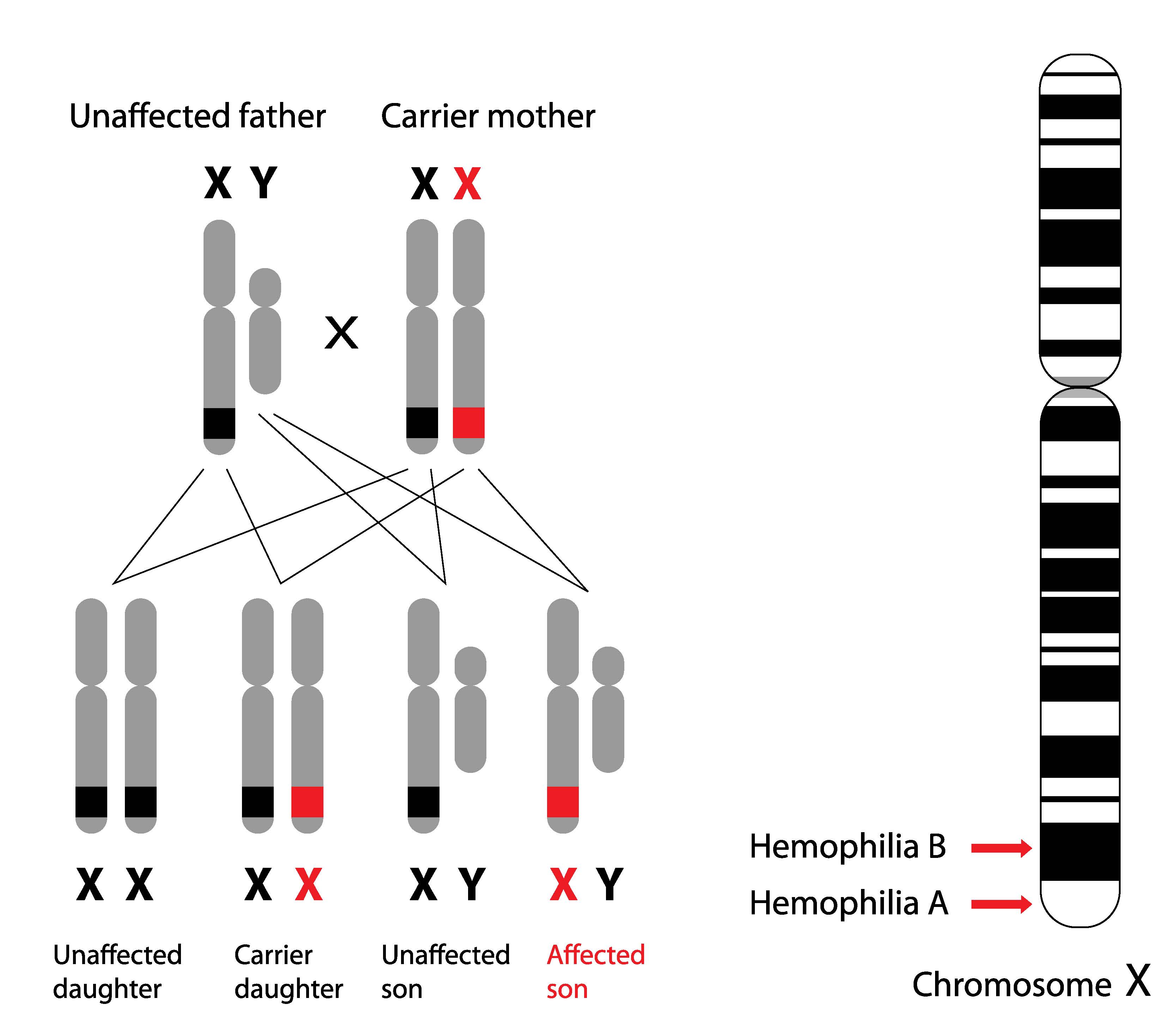 Genetics, hemophilia b